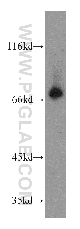 Western Blot (WB) analysis of human testis tissue using CCDC93 Polyclonal antibody (20861-1-AP)