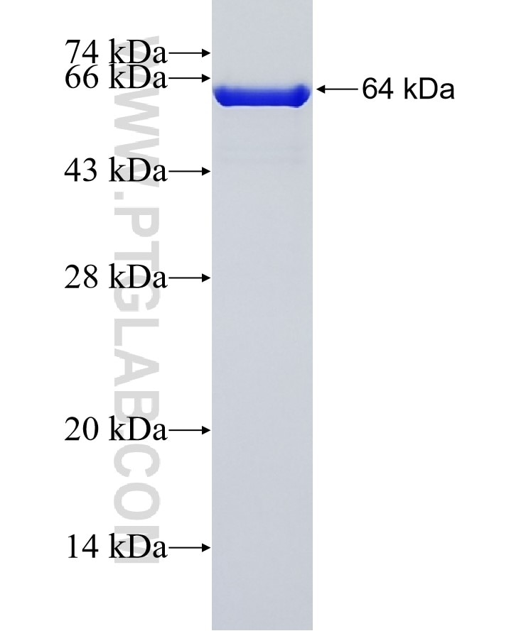 CCDC93 fusion protein Ag14855 SDS-PAGE