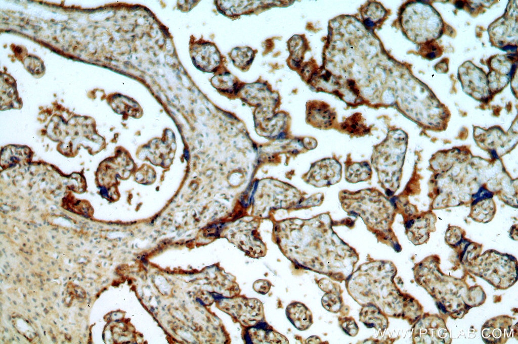 Immunohistochemistry (IHC) staining of human placenta tissue using CCDC94 Polyclonal antibody (19431-1-AP)