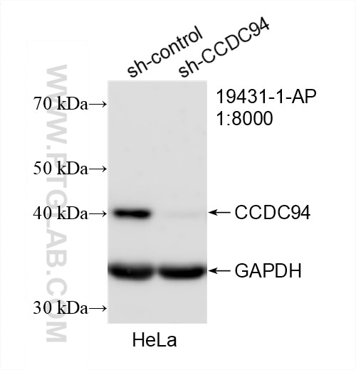 Western Blot (WB) analysis of HeLa cells using CCDC94 Polyclonal antibody (19431-1-AP)