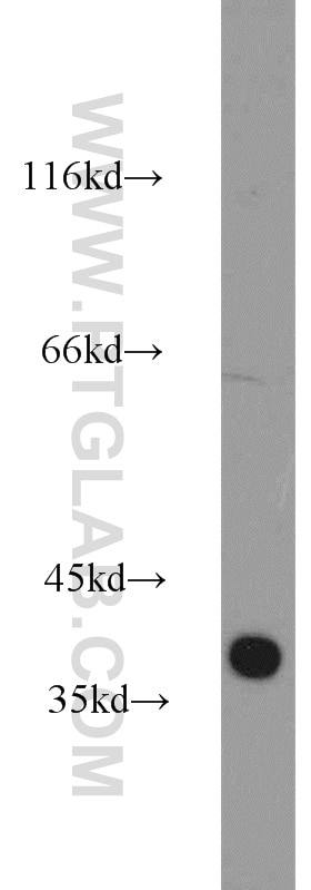 Western Blot (WB) analysis of mouse brain tissue using CCDC94 Polyclonal antibody (19431-1-AP)