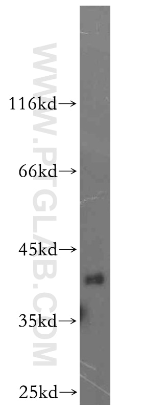 Western Blot (WB) analysis of mouse brain tissue using CCDC94 Polyclonal antibody (19431-1-AP)