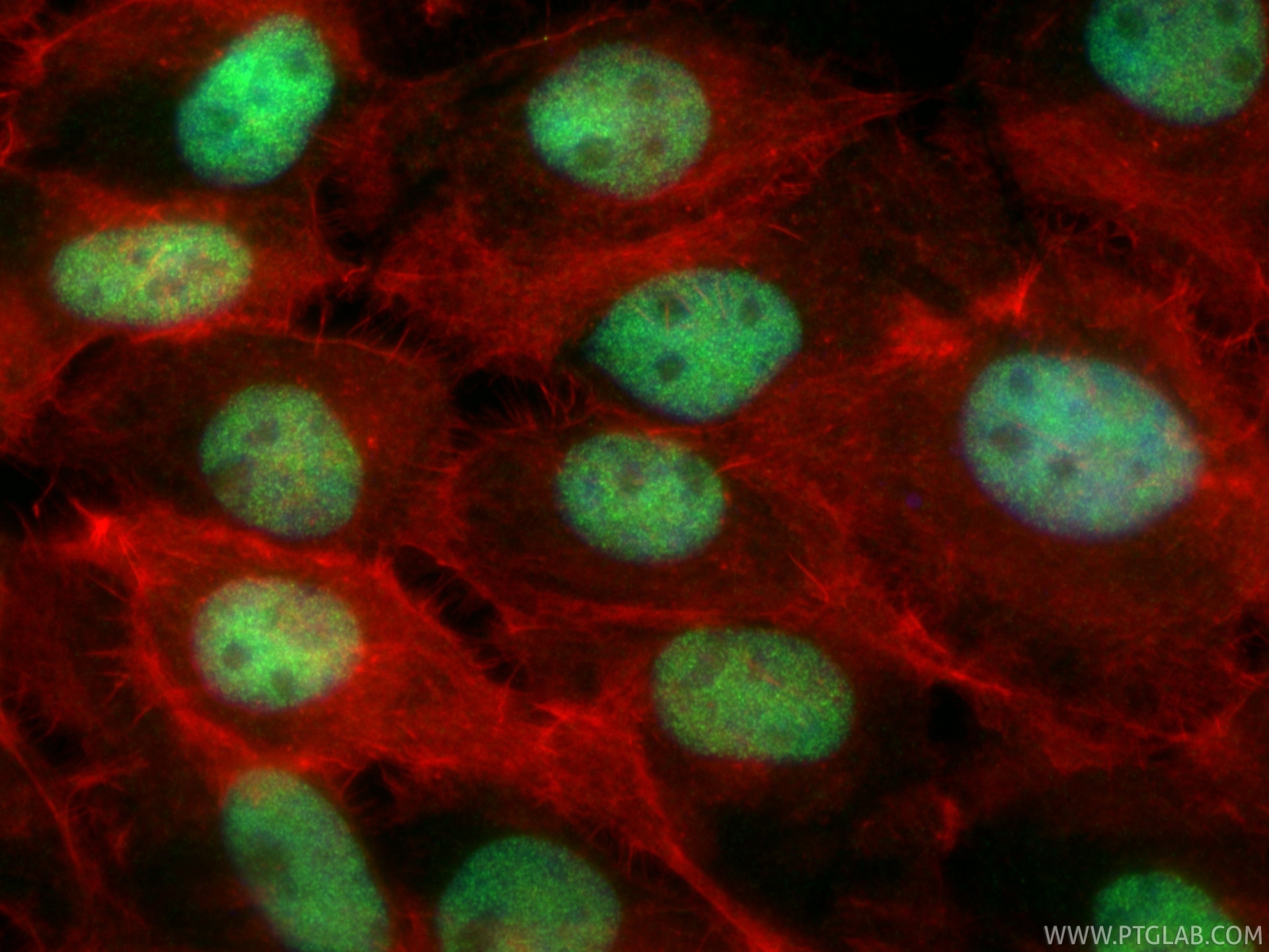 Immunofluorescence (IF) / fluorescent staining of A431 cells using CCDC94 Recombinant monoclonal antibody (83580-1-RR)
