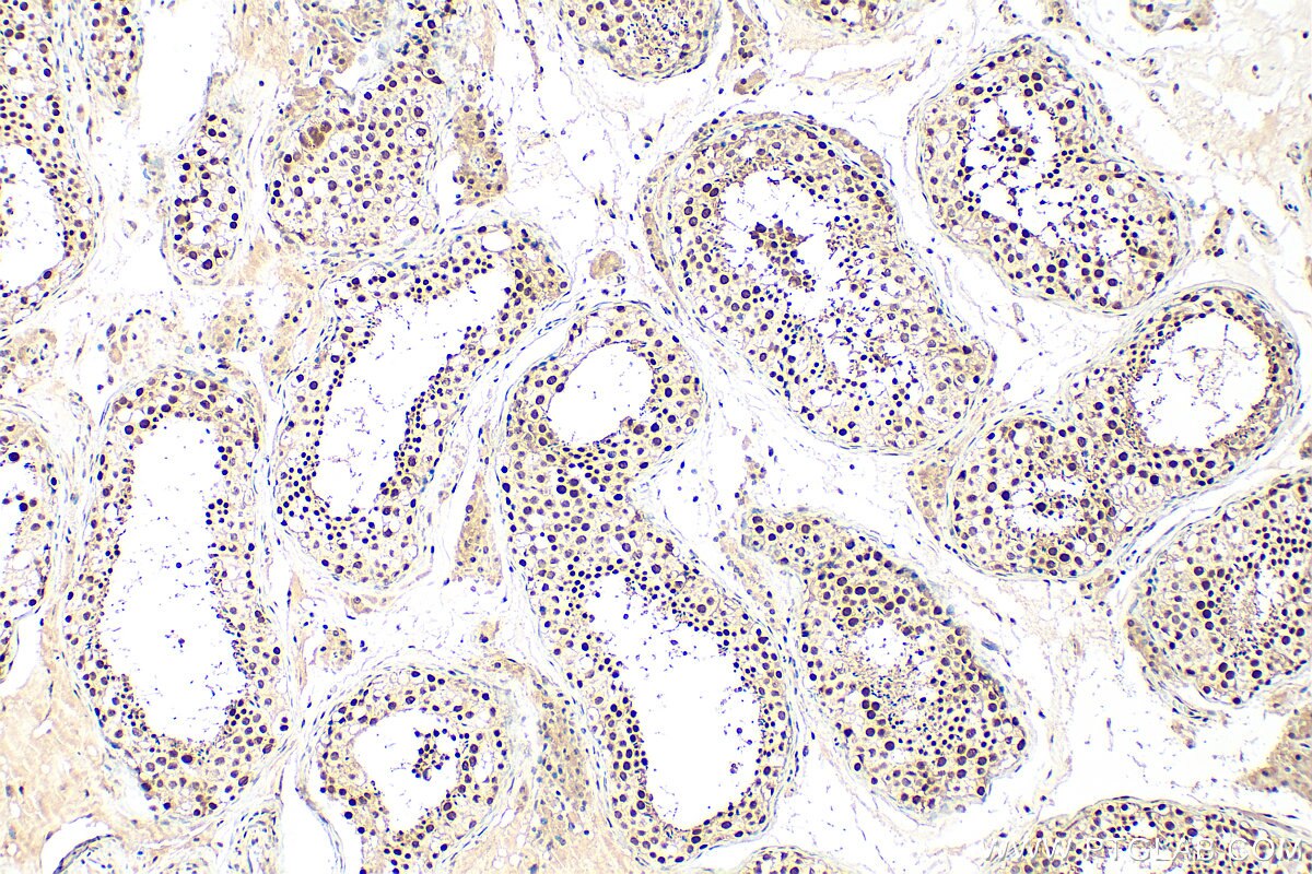 IHC staining of human testis using 31996-1-AP Immunohistochemistry (IHC) staining of human testis tissue using CCDC97 Polyclonal antibody (31996-1-AP)