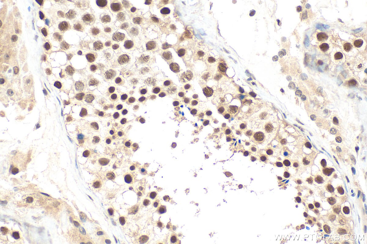 IHC staining of human testis using 31996-1-AP Immunohistochemistry (IHC) staining of human testis tissue using CCDC97 Polyclonal antibody (31996-1-AP)