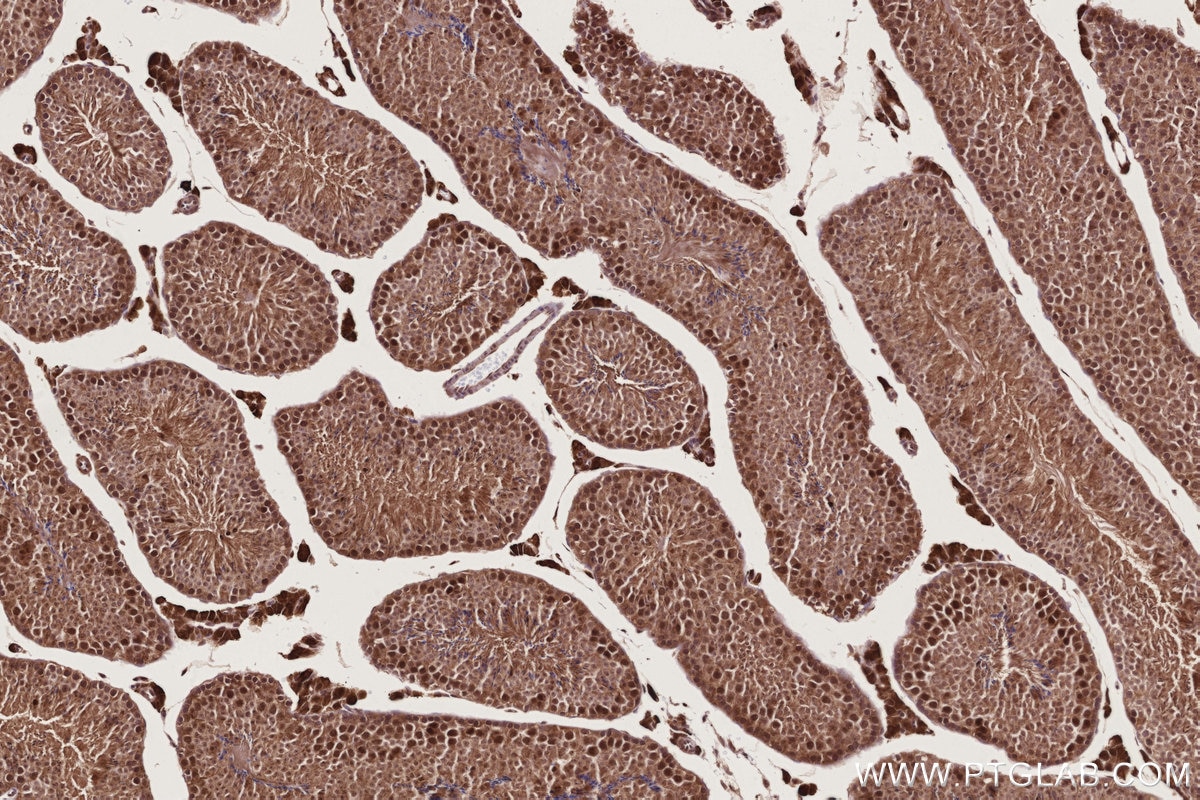 IHC staining of mouse testis using 24689-1-AP Immunohistochemistry (IHC) staining of mouse testis tissue using CCDC99 Polyclonal antibody (24689-1-AP)