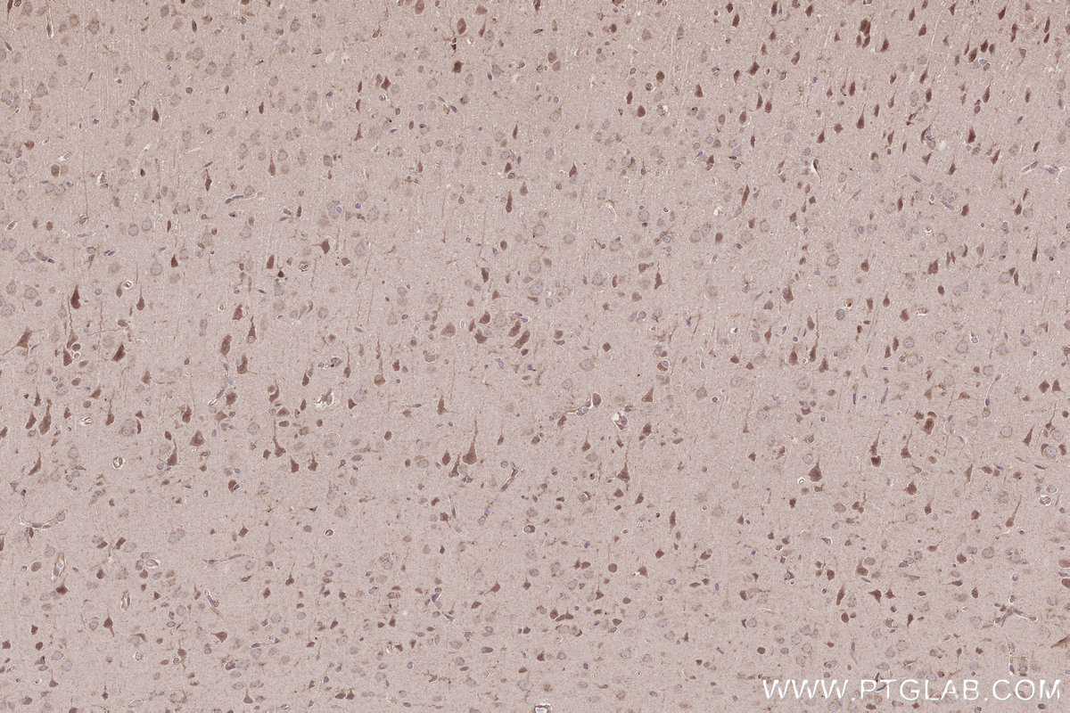 IHC staining of rat brain using 24689-1-AP Immunohistochemistry (IHC) staining of rat brain tissue using CCDC99 Polyclonal antibody (24689-1-AP)