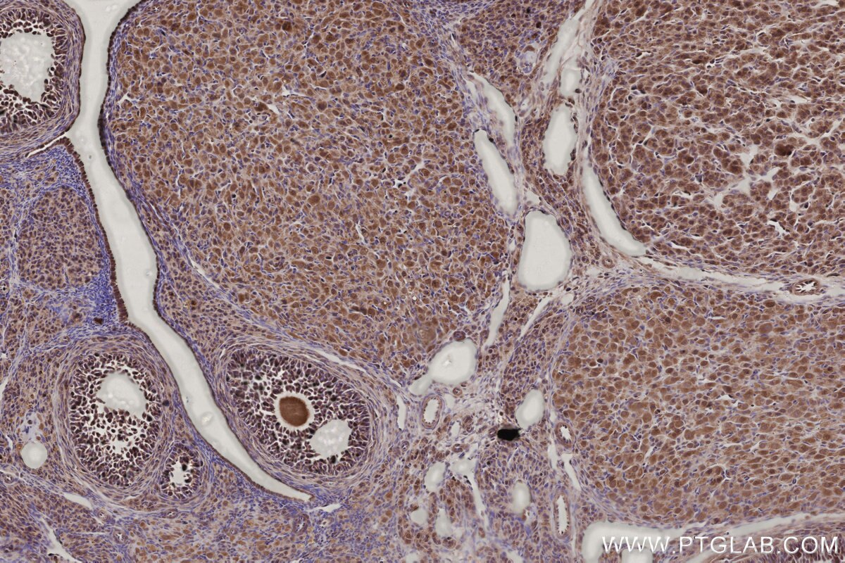 IHC staining of rat ovary using 24689-1-AP Immunohistochemistry (IHC) staining of rat ovary tissue using CCDC99 Polyclonal antibody (24689-1-AP)