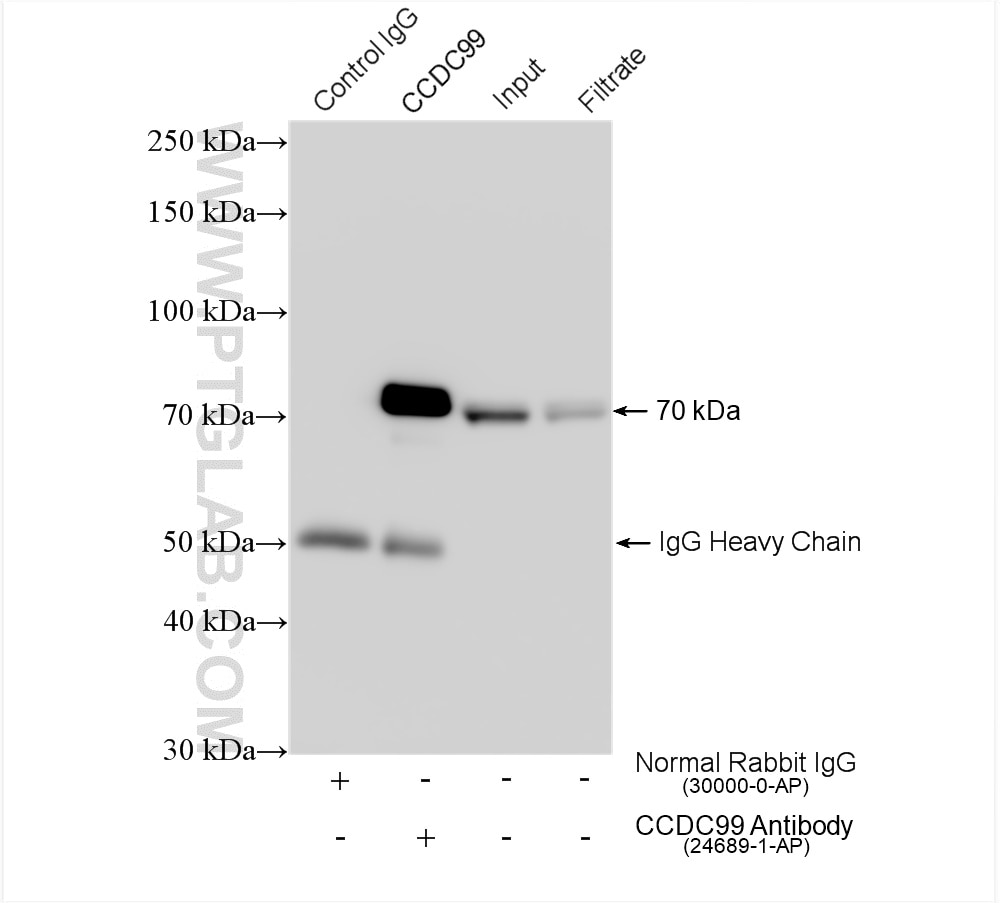 Immunoprecipitation (IP) experiment of HEK-293 cells using CCDC99 Polyclonal antibody (24689-1-AP)