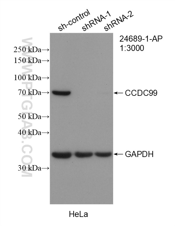 Western Blot (WB) analysis of HeLa cells using CCDC99 Polyclonal antibody (24689-1-AP)