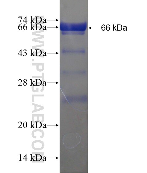 CCDC99 fusion protein Ag20430 SDS-PAGE