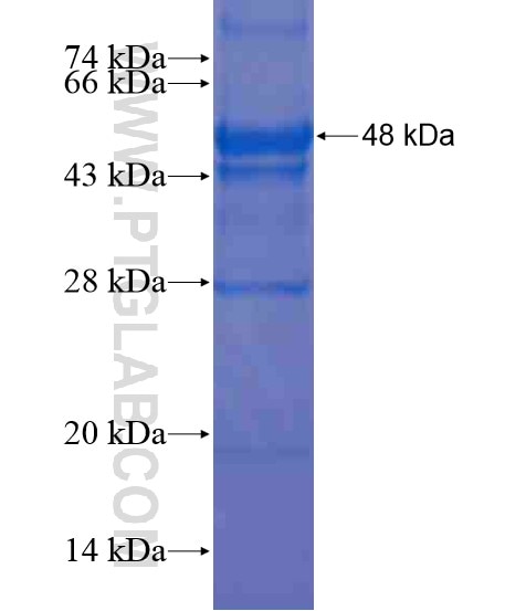 CCDC99 fusion protein Ag20439 SDS-PAGE