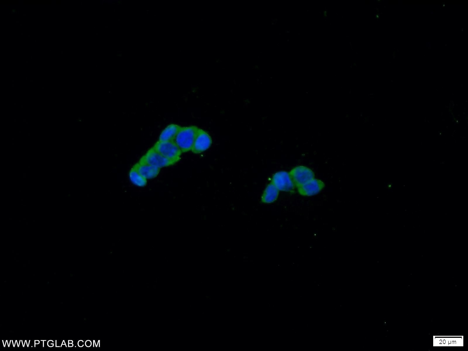 Immunofluorescence (IF) / fluorescent staining of HEK-293 cells using CCHCR1 Polyclonal antibody (21869-1-AP)