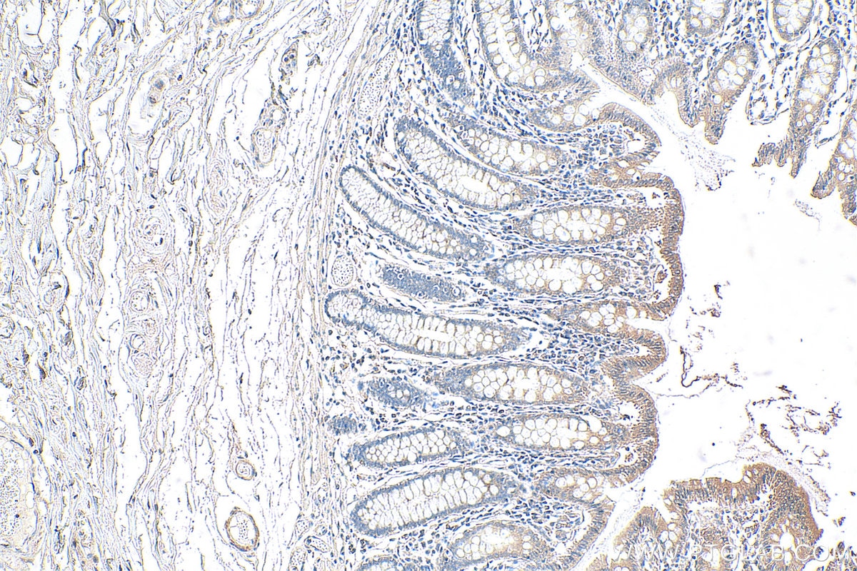 Immunohistochemistry (IHC) staining of human colon tissue using CCHCR1 Polyclonal antibody (21869-1-AP)