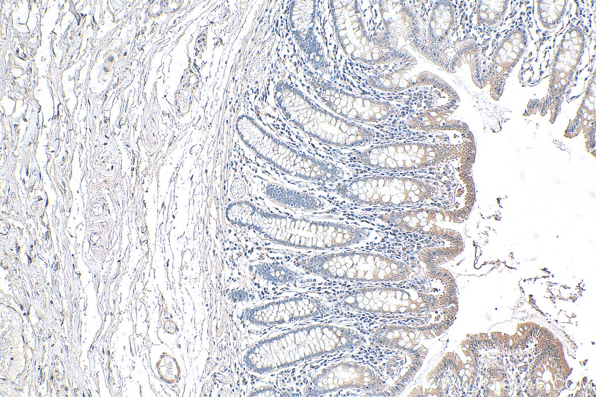 IHC staining of human colon using 21869-1-AP