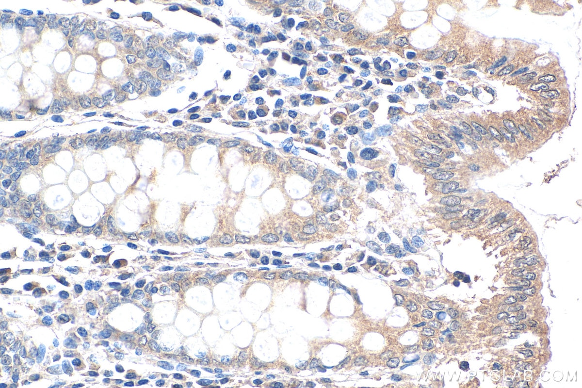 Immunohistochemistry (IHC) staining of human colon tissue using CCHCR1 Polyclonal antibody (21869-1-AP)