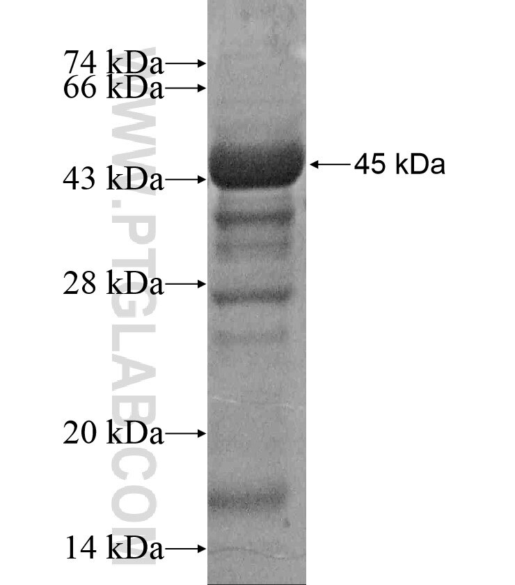 CCHCR1 fusion protein Ag17482 SDS-PAGE