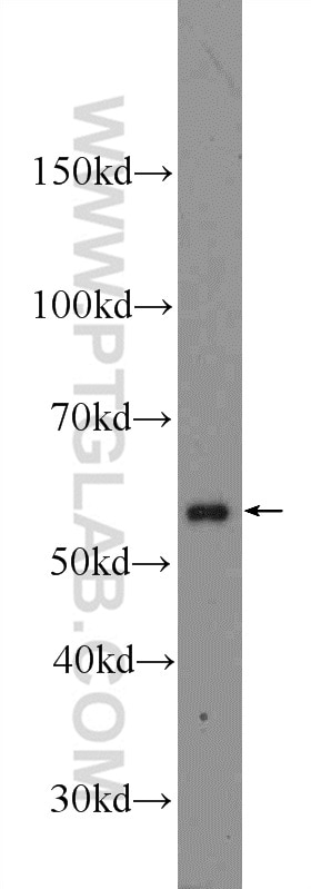 Western Blot (WB) analysis of rat testis tissue using Calicin Polyclonal antibody (13972-1-AP)