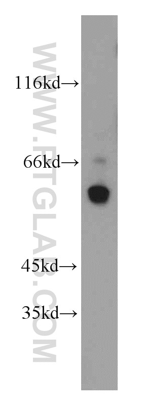 Western Blot (WB) analysis of human testis tissue using Calicin Polyclonal antibody (13972-1-AP)