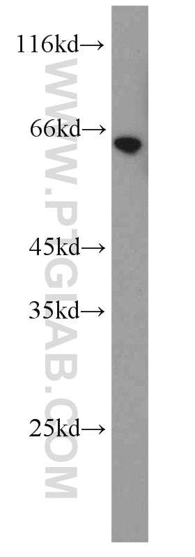 Western Blot (WB) analysis of human testis tissue using Calicin Polyclonal antibody (13972-1-AP)