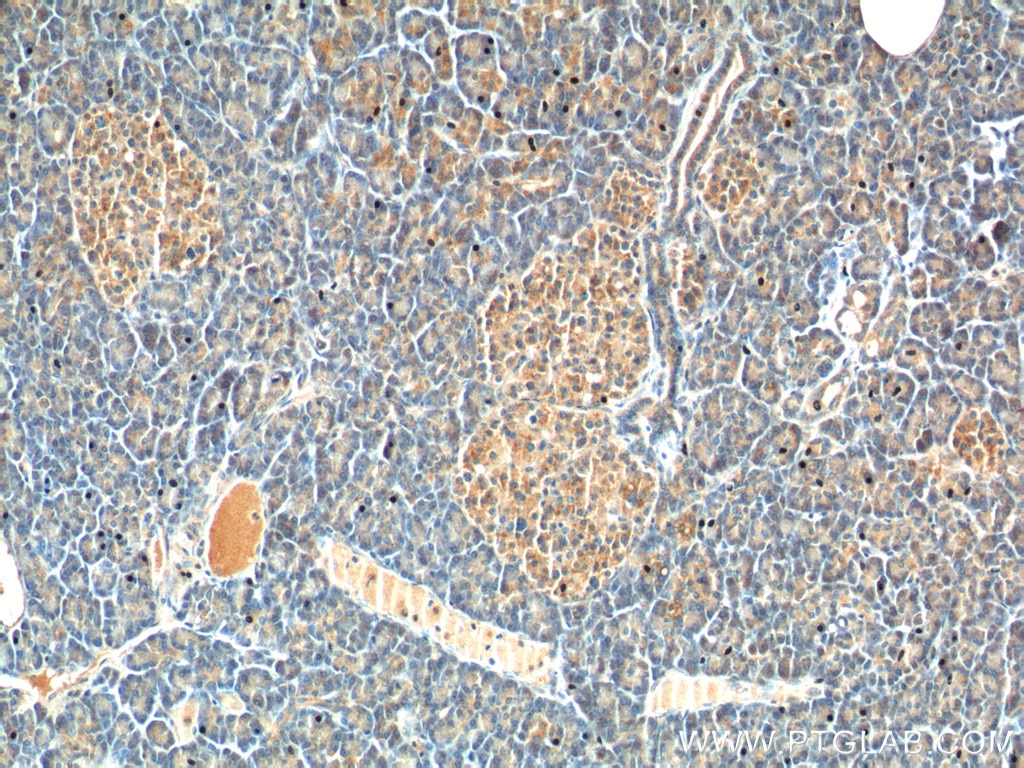 Immunohistochemistry (IHC) staining of human pancreas tissue using CCK Polyclonal antibody (13074-2-AP)