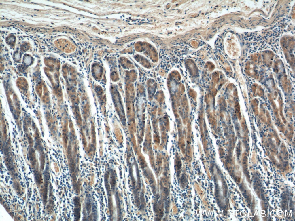 Immunohistochemistry (IHC) staining of human stomach tissue using CCK Polyclonal antibody (13074-2-AP)