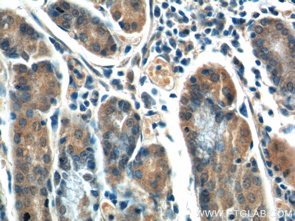 Immunohistochemistry (IHC) staining of human stomach tissue using CCK Polyclonal antibody (13074-2-AP)