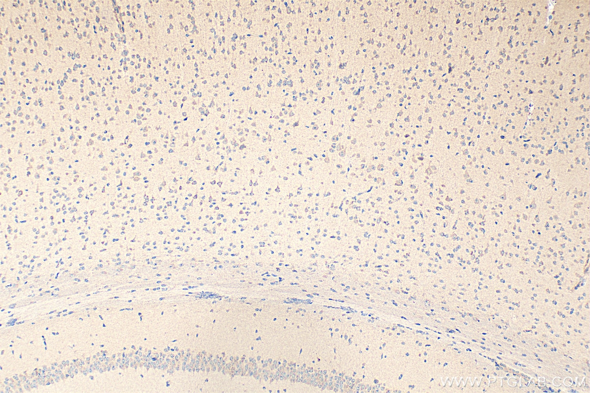 Immunohistochemistry (IHC) staining of mouse brain tissue using CCK Polyclonal antibody (13074-2-AP)