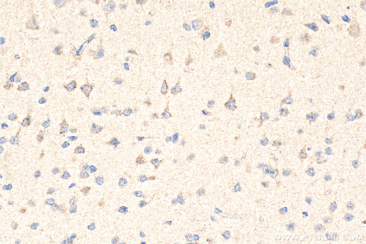 Immunohistochemistry (IHC) staining of mouse brain tissue using CCK Polyclonal antibody (13074-2-AP)