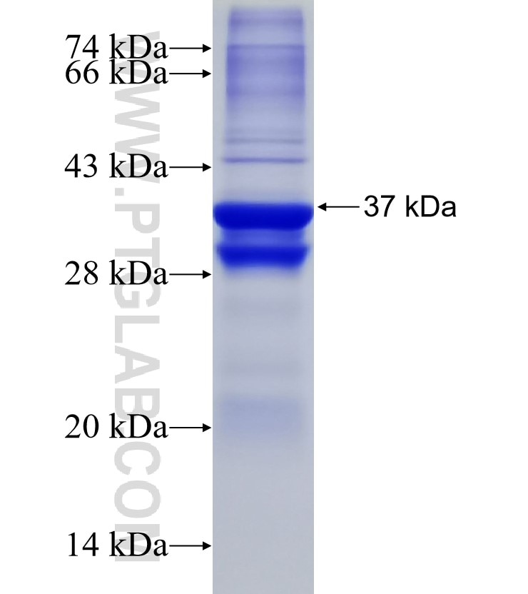 CCK fusion protein Ag3725 SDS-PAGE
