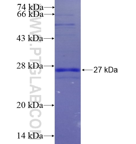 CCKAR fusion protein Ag12615 SDS-PAGE