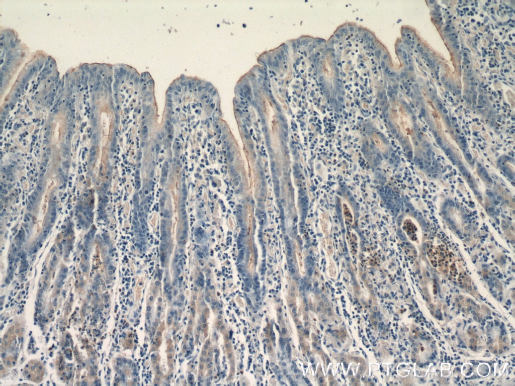 Immunohistochemistry (IHC) staining of human stomach tissue using CCKAR-specific Polyclonal antibody (16550-1-AP)