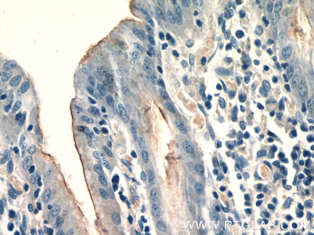 Immunohistochemistry (IHC) staining of human stomach tissue using CCKAR-specific Polyclonal antibody (16550-1-AP)