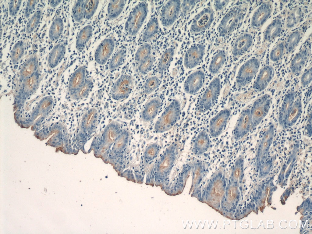 Immunohistochemistry (IHC) staining of human stomach tissue using CCKAR-specific Polyclonal antibody (16550-1-AP)