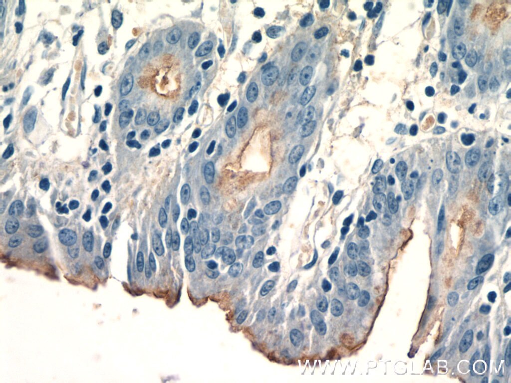 Immunohistochemistry (IHC) staining of human stomach tissue using CCKAR-specific Polyclonal antibody (16550-1-AP)