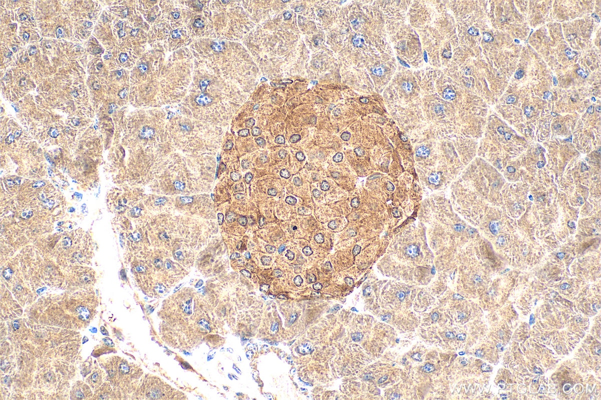 Immunohistochemistry (IHC) staining of mouse pancreas tissue using CCKAR-specific Polyclonal antibody (16550-1-AP)