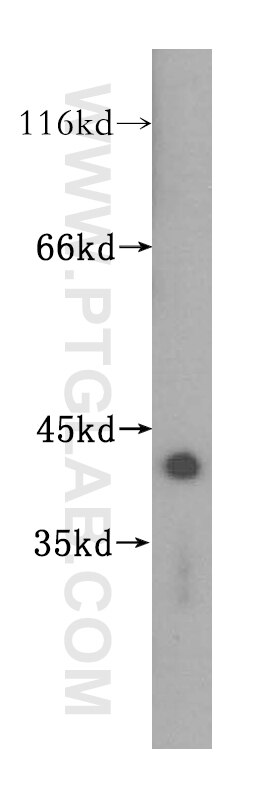 CCKAR-specific