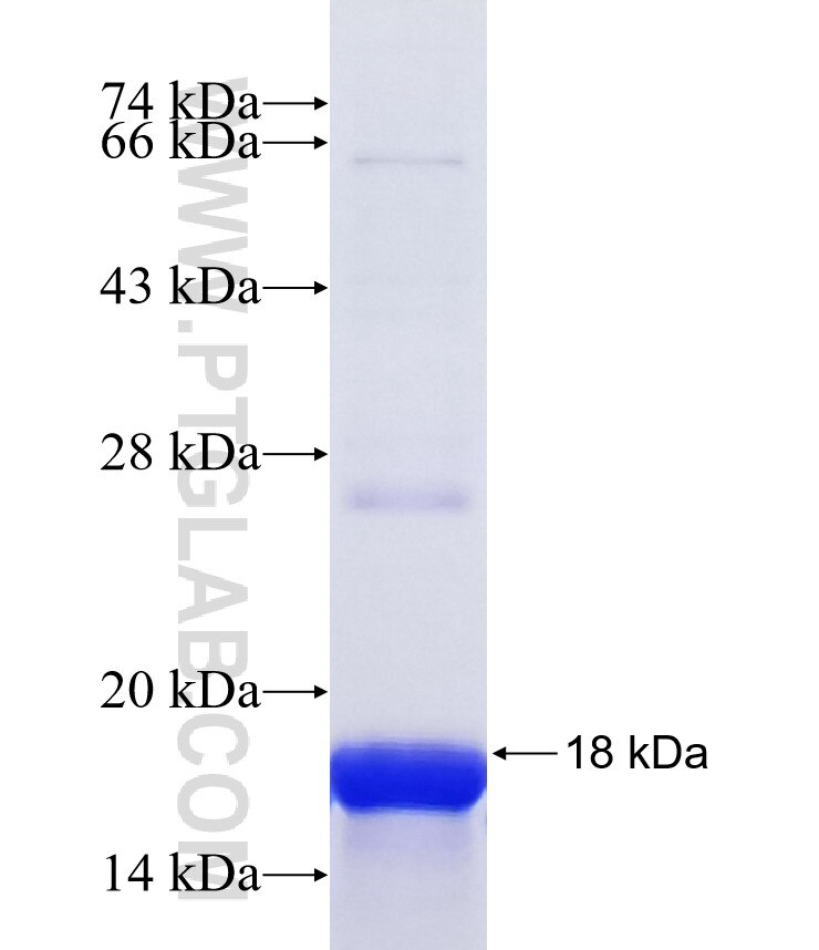 CCKBR fusion protein Ag39937 SDS-PAGE CCKBR fusion protein Ag39937 SDS-PAGE