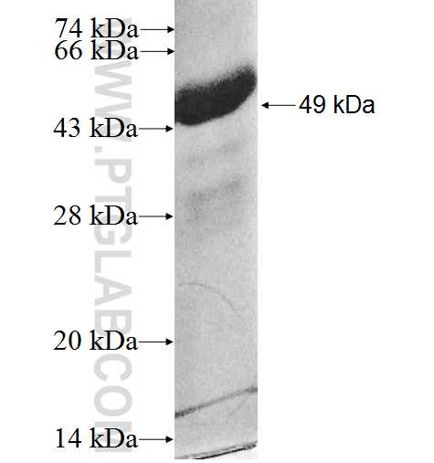 CCKBR fusion protein Ag0189 SDS-PAGE