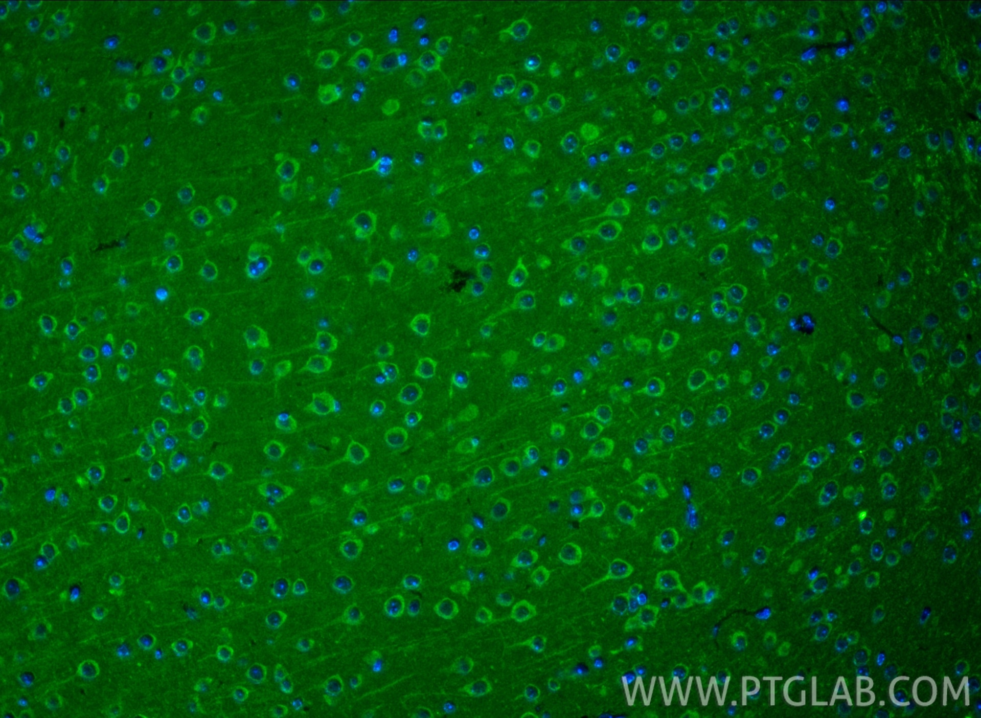 Immunofluorescence (IF) / fluorescent staining of mouse brain tissue using CCKBR-specific Polyclonal antibody (16549-1-AP)