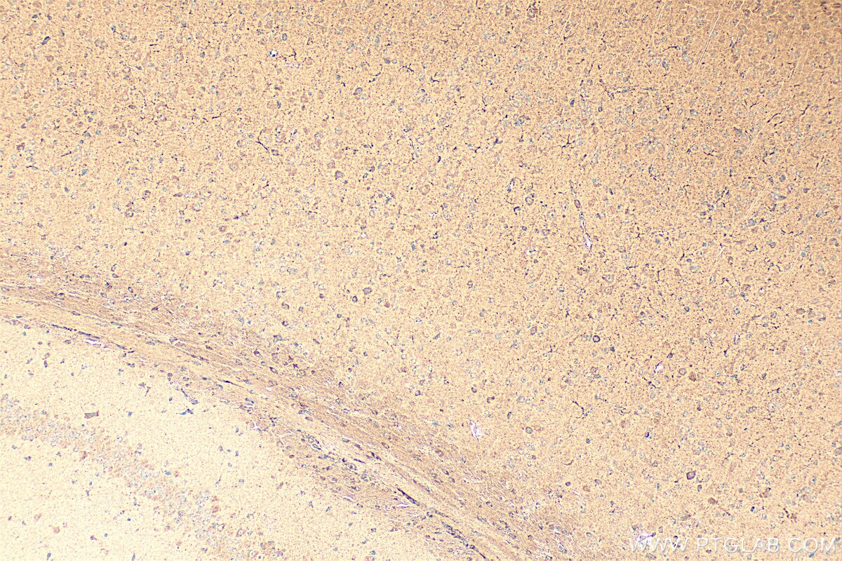 Immunohistochemistry (IHC) staining of mouse brain tissue using CCKBR-specific Polyclonal antibody (16549-1-AP)