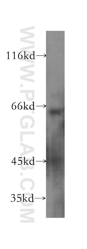 Western Blot (WB) analysis of SGC-7901 cells using CCKBR-specific Polyclonal antibody (16549-1-AP)