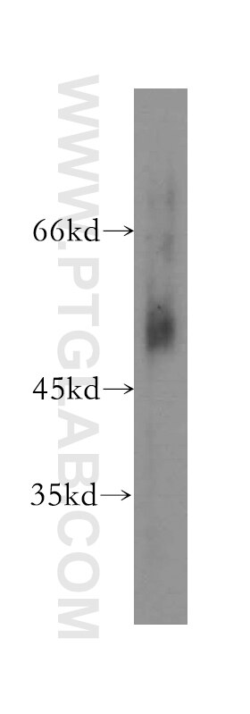 Western Blot (WB) analysis of human stomach tissue using CCKBR-specific Polyclonal antibody (16549-1-AP)