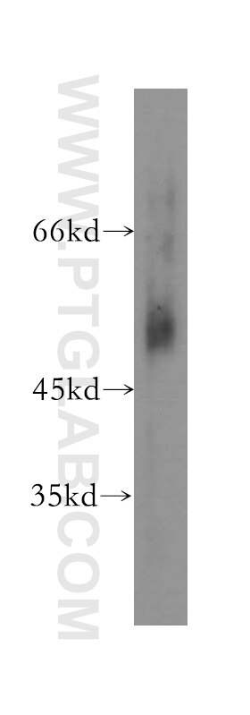 WB analysis of human stomach using 16549-1-AP