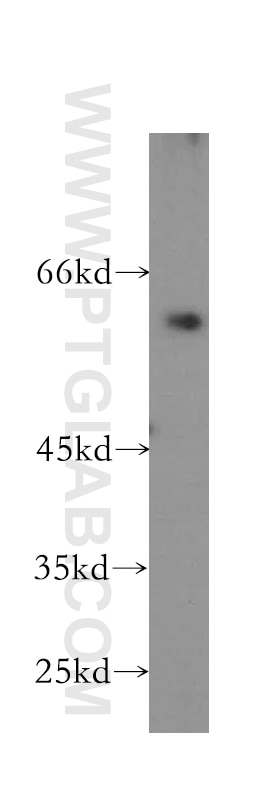 Western Blot (WB) analysis of BxPC-3 cells using CCKBR-specific Polyclonal antibody (16549-1-AP)