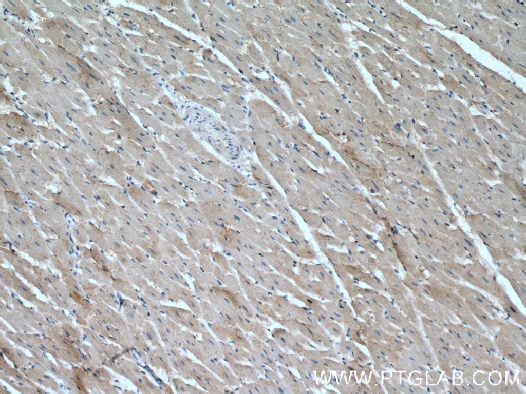 Immunohistochemistry (IHC) staining of human heart tissue using CCL14 Polyclonal antibody (14216-1-AP)