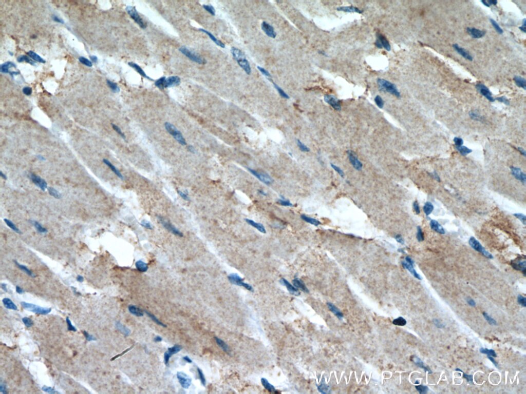 Immunohistochemistry (IHC) staining of human heart tissue using CCL14 Polyclonal antibody (14216-1-AP)