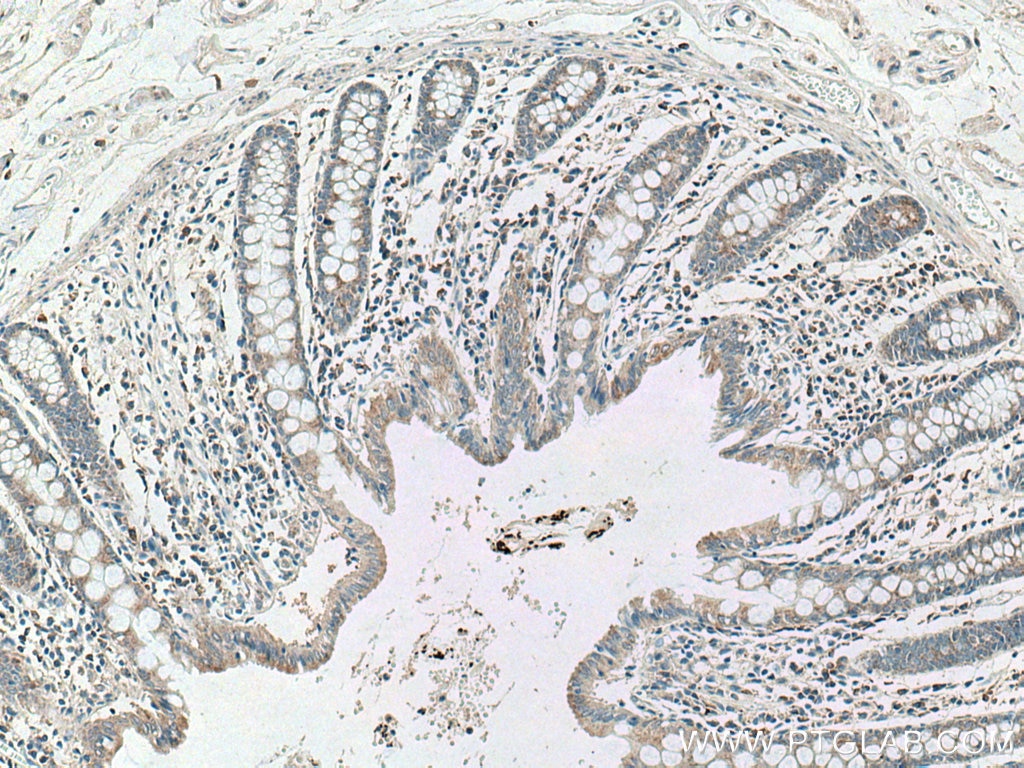 Immunohistochemistry (IHC) staining of human colon tissue using CCL17 Polyclonal antibody (22342-1-AP)