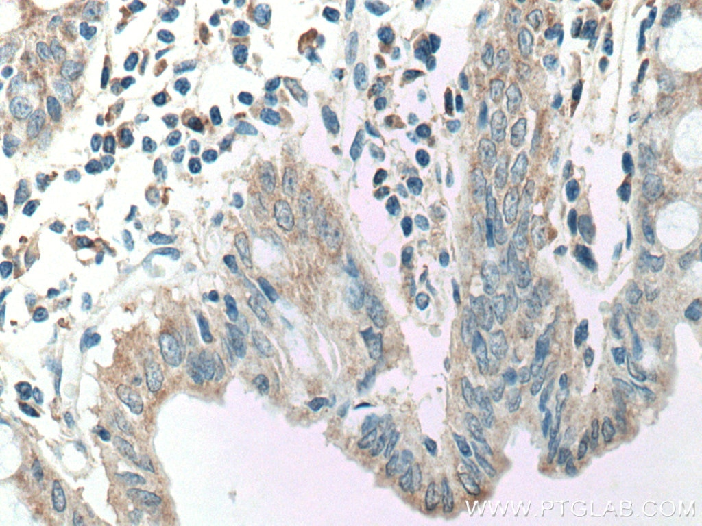 Immunohistochemistry (IHC) staining of human colon tissue using CCL17 Polyclonal antibody (22342-1-AP)