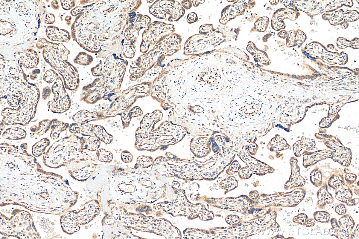 Immunohistochemistry (IHC) staining of human placenta tissue using CCL17 Polyclonal antibody (22342-1-AP)